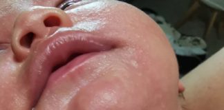 Bambina salva per miracolo, tragedia sfiorata ad Anzio bimba