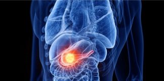 Diabete Italia in audizione presso Intergruppo Parlamentare sulle cronicità diabete