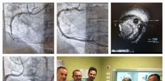 Malattie coronariche trattate con il laser: è la prima volta all’Emodinamica della Cardiologia dei Castelli Foto equipe Emodinamica UOC