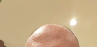 Angelo Pugliese: “L’opposizione ad Anzio dovrebbe cambiare hashtag: #nostalgiacanaglia”