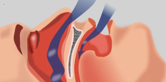 Sindrome delle apnee ostruttive del sonno: manifestazioni, diagnosi e terapia foto tratta dal web